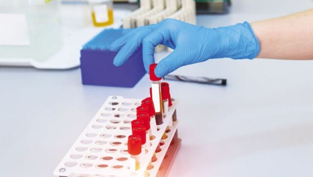 DOPING-SKANDAL-Neutralni-Rus-pao-u-Albaniji-suspendovan-na-dve.jpg Doping skandal neutralni rus pao u albaniji suspendovan na dve.jpg