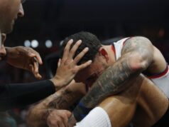 Katastrofa za Efes: DŽejms operisan, Amerikanac završio sezonu! Evo koliko će pauzirati! Katastrofa za Efes DZejms operisan Amerikanac zavrsio sezonu Evo koliko.jpg