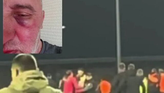 SKANDAL TRESE REGION Fudbaleri Zeljeznicara brutalno pretukli fotografa Sloge.jpg